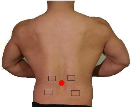 Posterior_view_of_lumbar_region_for_electrostimulation_electrode_placement